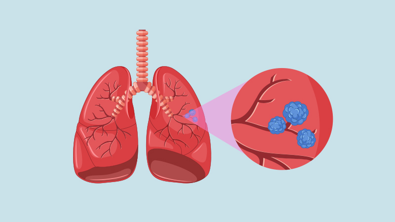 como-son-pulmones.jpg