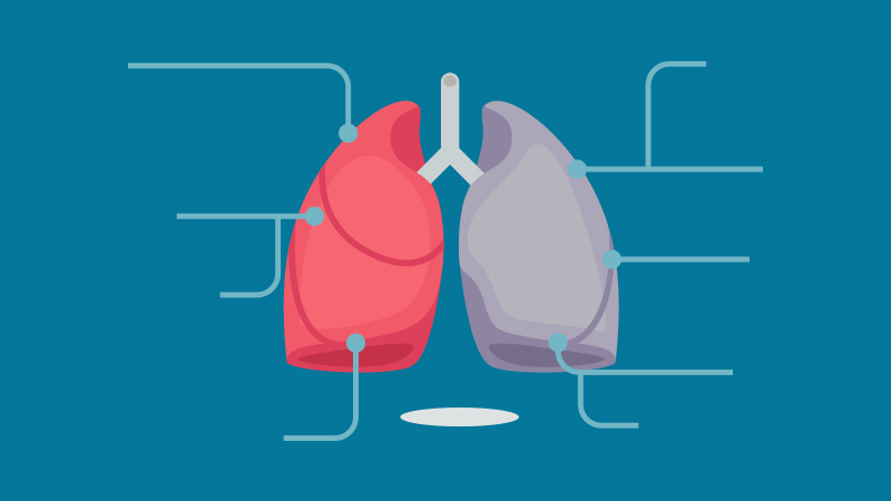 enfermedad_pulmonar_fibrosis.jpg